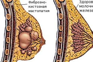 Как правильно массировать грудь: правила и основные техники выполнения массажа Масаж для груди для увеличения