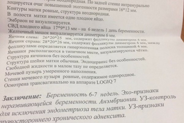 Kra38at